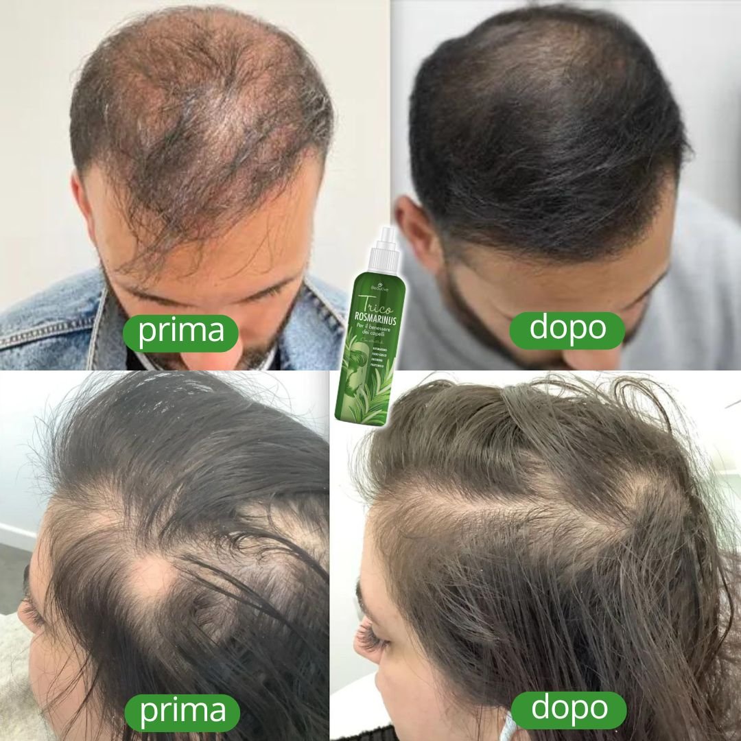 Trico Rosmarinus: Lozione Capelli, Funziona? Ingredienti E Benefici - Foto 3